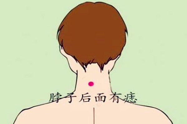 女人脖子左侧有痣命好吗